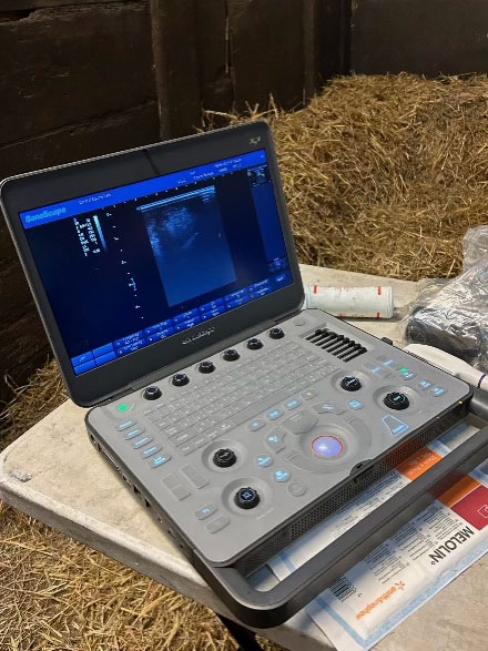 Portable ultrasound scanner delivering immediate results