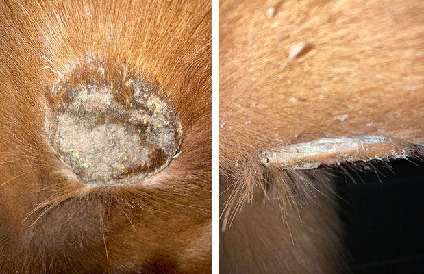 Verrucous sarcoid following AW5 treatment | Sarcoid starting to come away following treatment